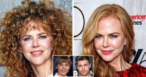 Stars with Unsuccessful Plastic Surgery